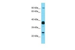 Josephin1 Rabbit anti-Human, Polyclonal, Novus Biologicals 0.1 mL | Buy Online | Novus Biologicals | Fisher Scientific